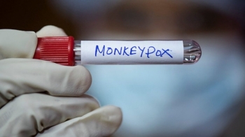 OBSH shpalli fundin e epidemisë së lisë së majmunit 