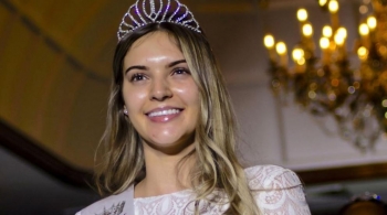U mbajt konkursi i parë botëror për Miss pa grim: Fitoi 26-vjeçarja Natasha