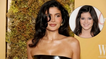 Kylie Jenner kritikohet sërish për procedurat estetike, buzët e saj konsiderohen ‘të shtrembëruara’