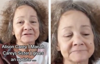 Motra e Mariah Carey zbulon se ajo ka humbur të gjithë dhëmbët e saj,nuk ka para t'i zëvendësoj