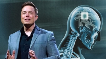 Elon Musk thotë se Neuralink ka implantuar çipin e parë të trurit te një njeri