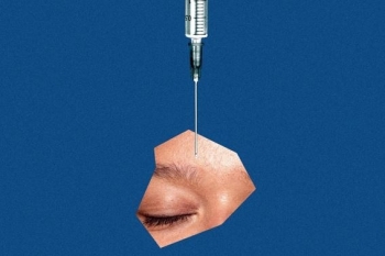 Të rinjtë po vendosin Botox për të parandaluar rrudhat