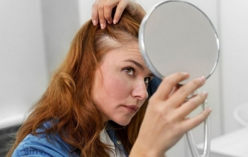 Si ndikon stresi te flokët?