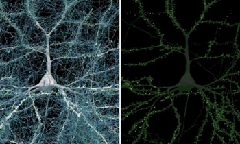 Google dhe Harvard zbulojnë hartën më të detajuar ndonjëherë të trurit të njeriut