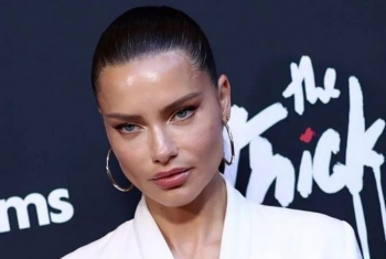 Adriana Lima befason fansat, kritikohet për përdorim të tepërt të botoksit