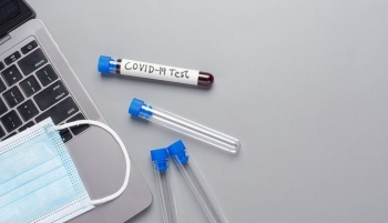 Alarm në Evropë për teste të rreme të kombinuara për COVID-19 dhe grip