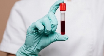 Gjaku menstrual mund të ndihmojë në zbulimin e shumë sëmundjeve tek gratë