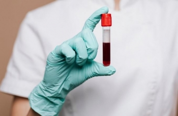 Shtohen aksionet për dhurim gjaku në Kosovë, FSK i bashkohet nismës