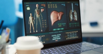 FDA miraton ilaçin e ri për kancerin e avancuar të pankreasit